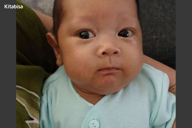 Perjuangan Gibran Melawan Infeksi Serratia