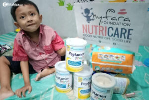 Susu Khusus untuk Pemenuhan Nutrisi Anak-anak Pejuang Atresia Bilier
