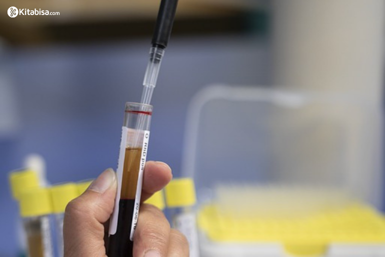 Kanker Serviks yang Menjalar ke Organ Lain