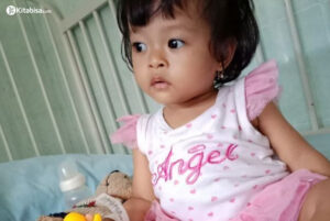 Atresia Ani, Ketika si Kecil Terlahir Tanpa Anus