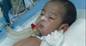 Alat Ventilator untuk Bayi Gagal Napas Bertahan HidupAlat Ventilator untuk Bayi Gagal Napas Bertahan Hidup