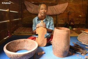 Perjuangan Maestro Kesenian Melawan Tumor Colli