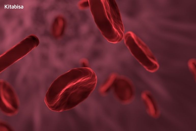 Cara Mencegah Kanker Darah Leukimia