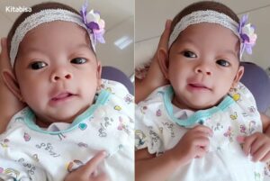 Cerita Zea Sembuh dari Penyakit Gastroschisis