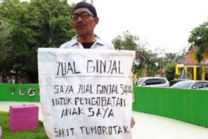 Bantu Anak Pak Eli Agar Bisa Operasi Tumor Otak