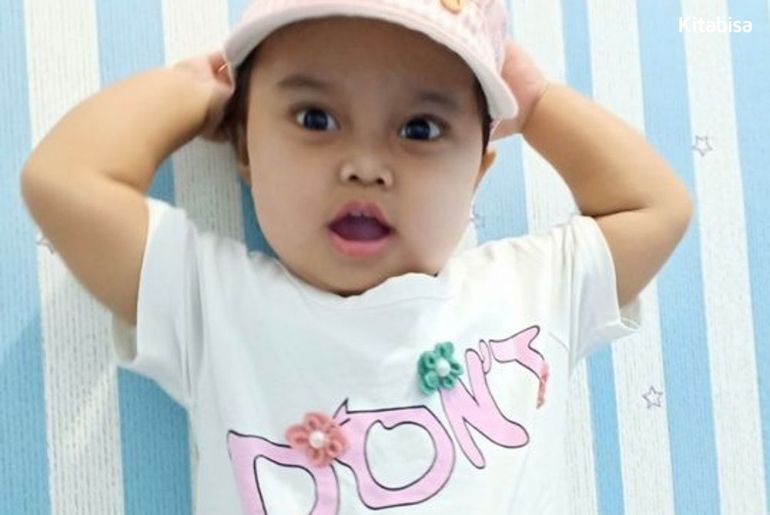 Galang Dana untuk Pengobatan Atresia Bilier