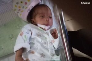 Bayi Kembar Prematur Pejuang NICU