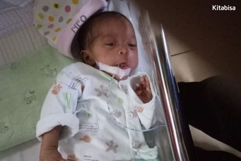 Bayi Kembar Prematur Pejuang NICU