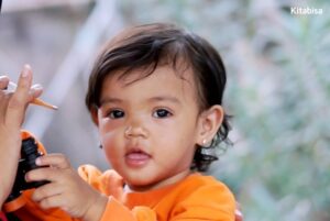 Cerita Kelainan Gastroschisis yang Diderita Bayi Sejak Lahir