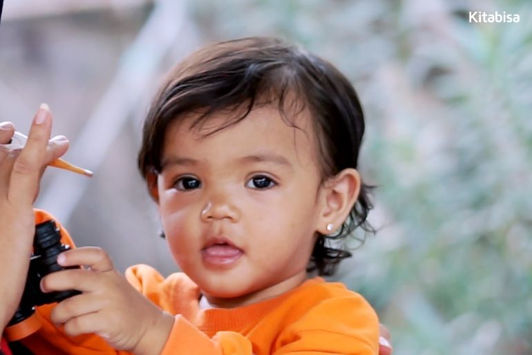 Cerita Kelainan Gastroschisis yang Diderita Bayi Sejak Lahir