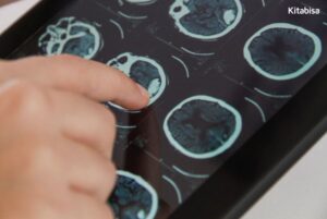 gejala tumor otak