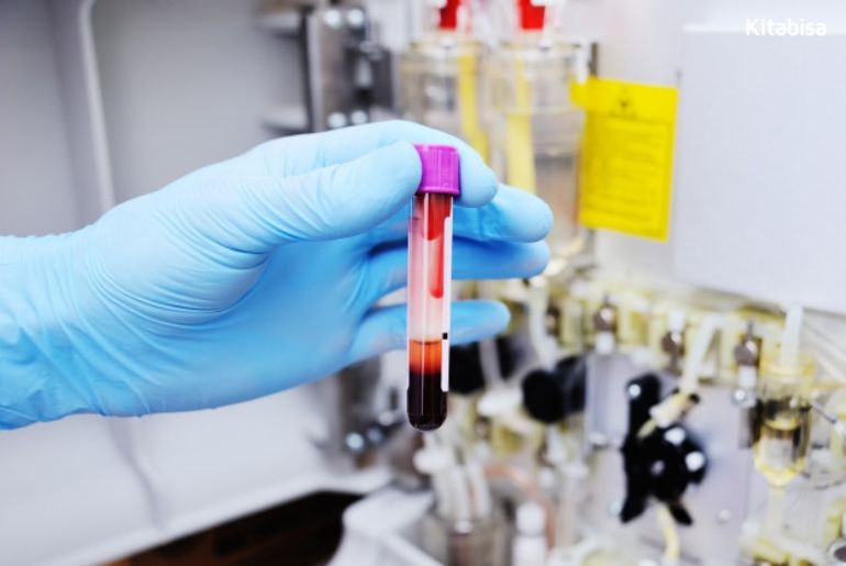 thalasemia adalah
