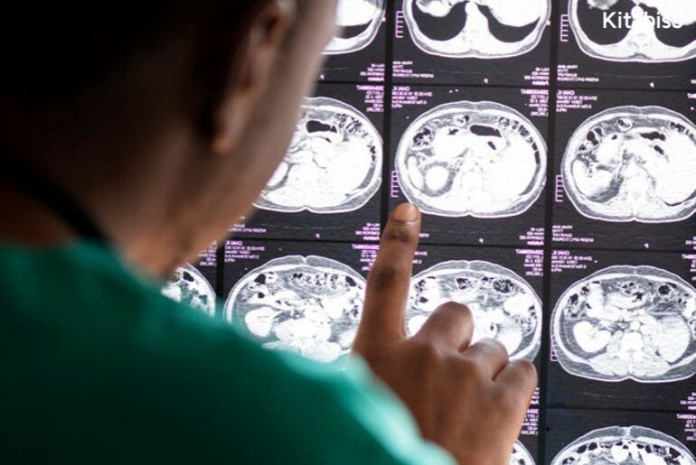 apa itu penyakit meningitis