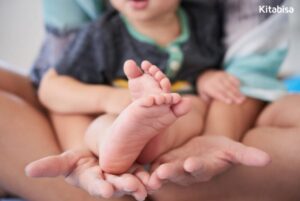 penyakit clubfoot