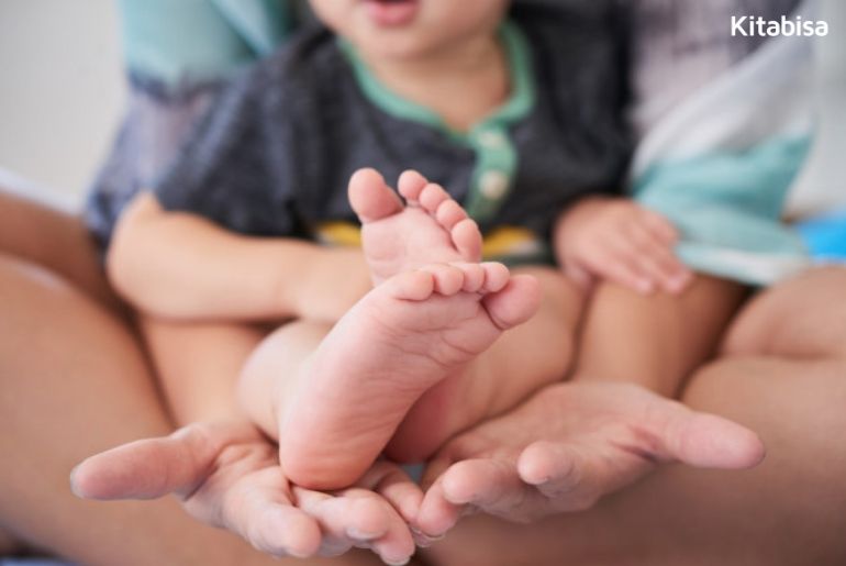 penyakit clubfoot
