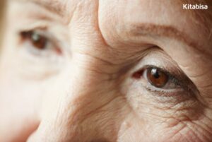 bell's palsy adalah