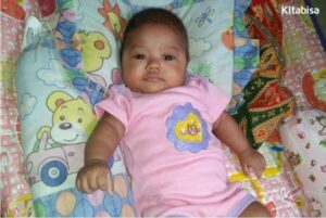 gizi buruk pada bayi