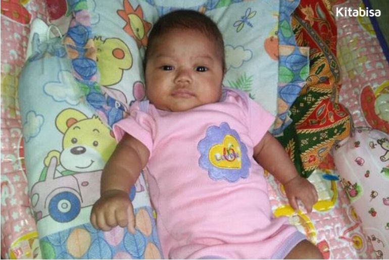 gizi buruk pada bayi