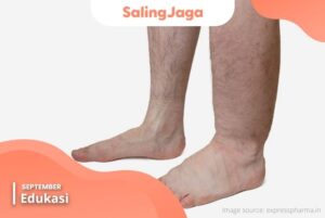 kaki gajah