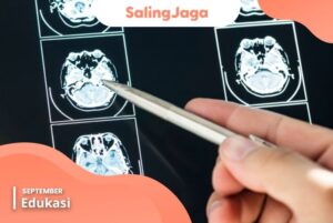 cedera kepala