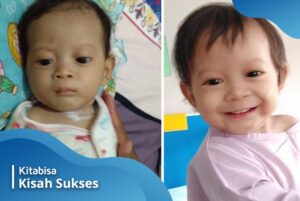 Fatih, Bayi Penyintas Jantung Bocor Kini Telah Sembuh
