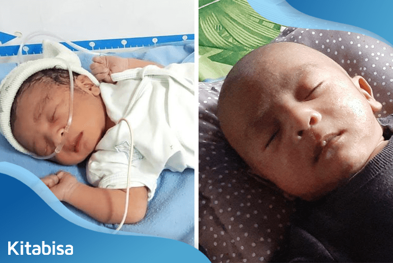 Mama Renzie Terserang DBD Saat Hamil, Renzie Harus Masuk NICU