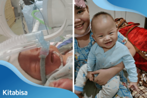 Lahir Prematur, Sekarang Brie Sudah Sembuh dan Keluar dari NICU