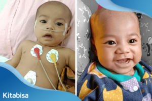 Aliqa, Anak Montir yang Sembuh dari Kelainan Jantung