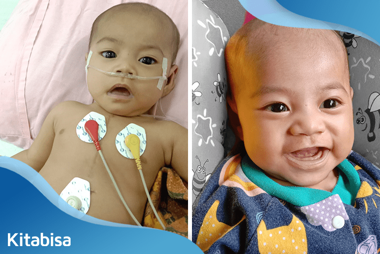 Aliqa, Anak Montir yang Sembuh dari Kelainan Jantung