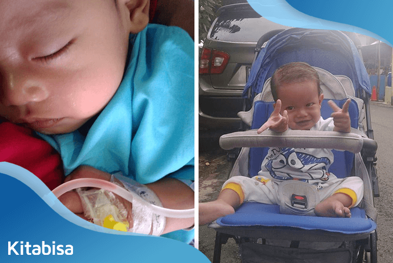 Kisah Anak Buruh Pabrik yang Sembuh dari Penyakit Jantung Bawaan